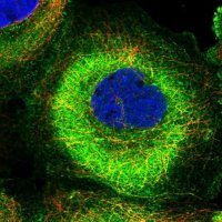 Anti-MADD antibody produced in rabbit