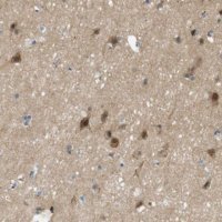 Anti-MAGI2 antibody produced in rabbit 