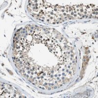Anti-MAGI2 antibody produced in rabbit 