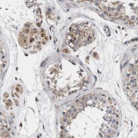Anti-MALSU1 antibody produced in rabbit 