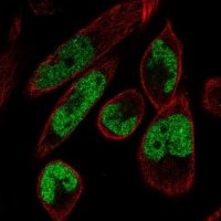 Anti-MAMLD1 antibody produced in rabbit 