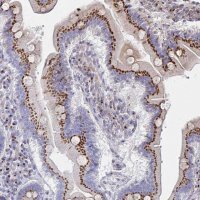 Anti-MAN1A1 antibody produced in rabbit 