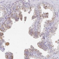 Anti-MANBA antibody produced in rabbit 