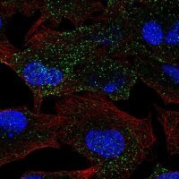 Anti-MANBA antibody produced in rabbit 