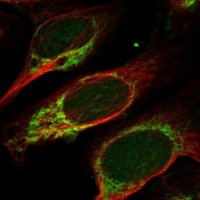 Anti-MANBAL antibody produced in rabbit
