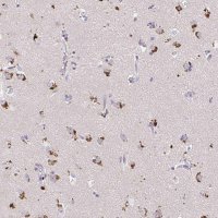 Anti-MAP1LC3A antibody produced in rabbit 