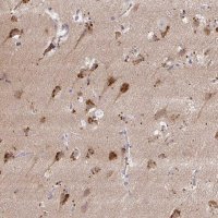 Anti-MAP1LC3A antibody produced in rabbit 