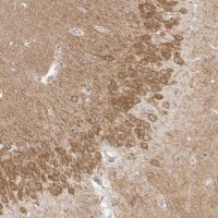 Anti-MAP2K1 antibody produced in rabbit 
