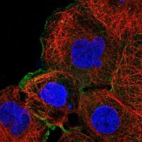 Anti-MAP2K1 antibody produced in rabbit 