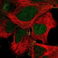 Anti-MAP2K4 antibody produced in rabbit 