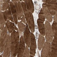Anti-MAP3K10 antibody produced in rabbit 