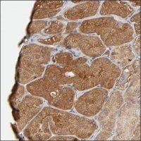 Anti-MAP3K15 antibody produced in rabbit HPA004006-100UL