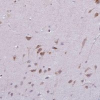 Anti-MAP7D2 antibody produced in rabbit 
