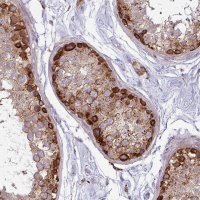 Anti-MAP7D2 antibody produced in rabbit 