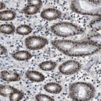 Anti-MAPKAPK5 antibody produced in rabbit 