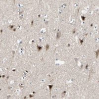 Anti-MARK1 antibody produced in rabbit 
