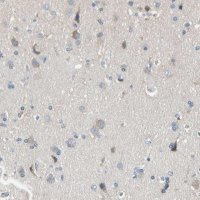 Anti-MARK1 antibody produced in rabbit 