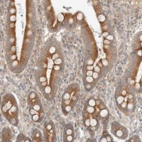 Anti-MARK3 antibody produced in rabbit 