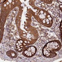 Anti-MARK4 antibody produced in rabbit 