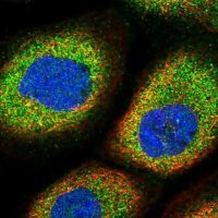 Anti-MARK4 antibody produced in rabbit 