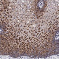 Anti-MAST4 antibody produced in rabbit 