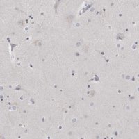 Anti-MATN1 antibody produced in rabbit