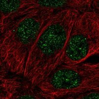 Anti-MBD2 antibody produced in rabbit 
