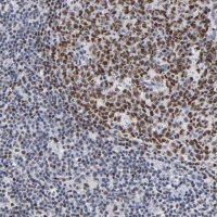 Anti-MBD4 antibody produced in rabbit