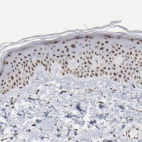 Anti-MBD4 antibody produced in rabbit