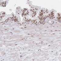 Anti-MBNL1 antibody produced in rabbit 