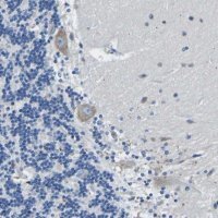 Anti-MC4R antibody produced in rabbit 