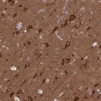 Anti-MCCC1 antibody produced in rabbit 