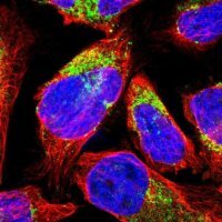 Anti-MCCC1 antibody produced in rabbit 