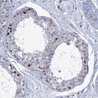 Anti-MCMBP antibody produced in rabbit