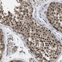 Anti-MCOLN2 antibody produced in rabbit 