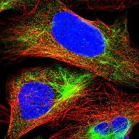 Anti-MCOLN2 antibody produced in rabbit 
