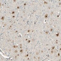Anti-MCPH1 antibody produced in rabbit 