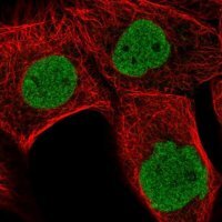 Anti-MDFI antibody produced in rabbit
