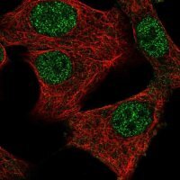 Anti-MED11 antibody produced in rabbit 