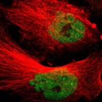 Anti-MED15 antibody produced in rabbit 