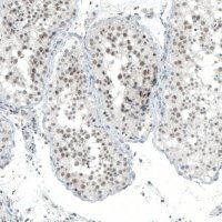 Anti-MED20 antibody produced in rabbit 