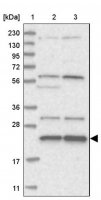 Anti-MED28 antibody produced in rabbit 