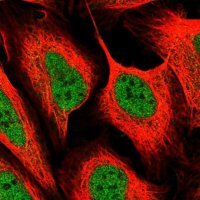 Anti-MED6 antibody produced in rabbit 