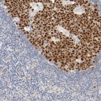 Anti-MEF2B antibody produced in rabbit