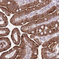 Anti-MEIS3 antibody produced in rabbit 