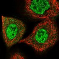 Anti-MEN1 antibody produced in rabbit 