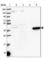 Anti-METAP1 antibody produced in rabbit 