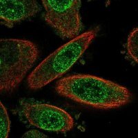 Anti-METRN antibody produced in rabbit 