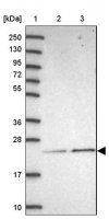 Anti-METTL26 antibody produced in rabbit 