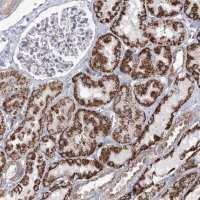Anti-METTL5 antibody produced in rabbit 